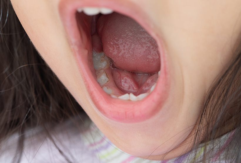 舌で歯を押す